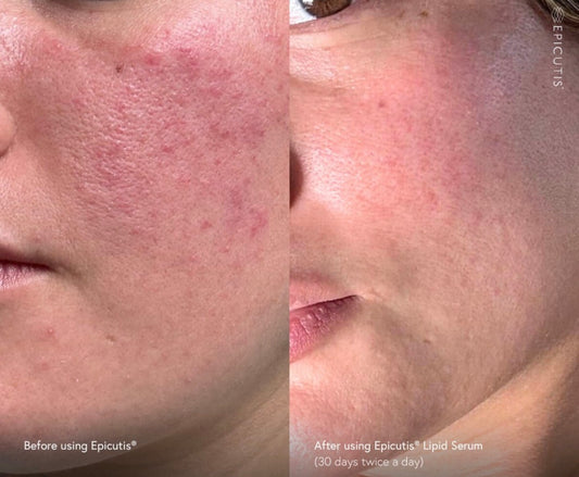 EPICUTIS® Luxury Skincare Set