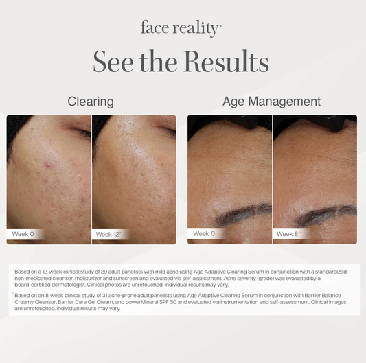 Face Reality Age Adaptive Clearing Serum