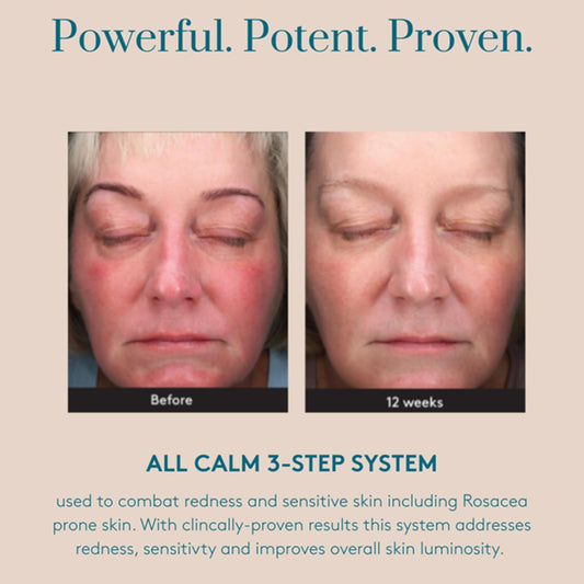 Colorescience All Calm Clinical Redness Corrector - SPF 50